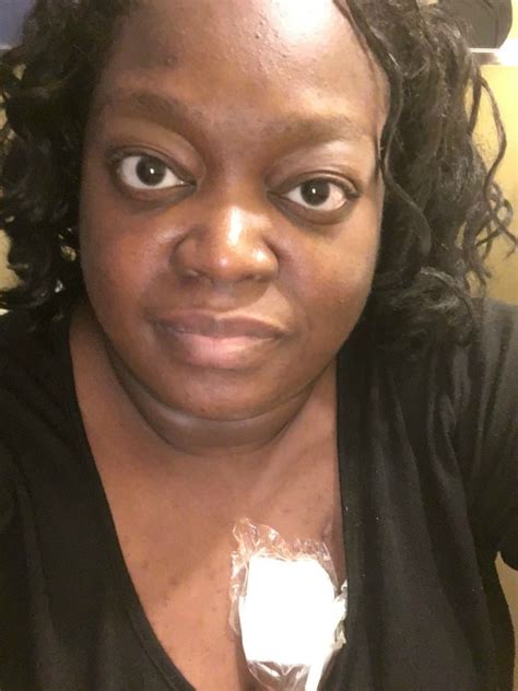what is fudge cancer|Fudge Cancer Update and Heartfelt Thanks .
